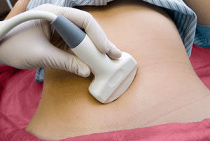 pelvic-ultrasound-image