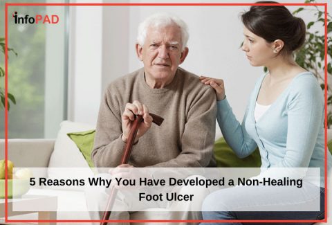 5 Reasons Why You Have Developed a Non-Healing Foot Ulcer Feature Image