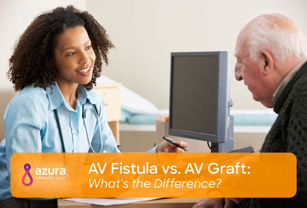 AV Fistula vs. AV Graft: What's the Difference? main image