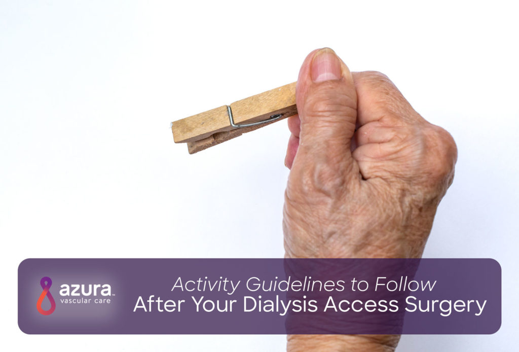 Activity Guidelines to Follow After Your Dialysis Access Surgery main image