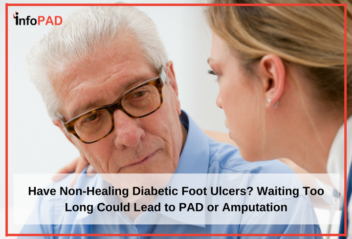 Have Non-Healing Diabetic Foot Ulcers? Waiting Too Long Could Lead to PAD or Amputation Feature Image