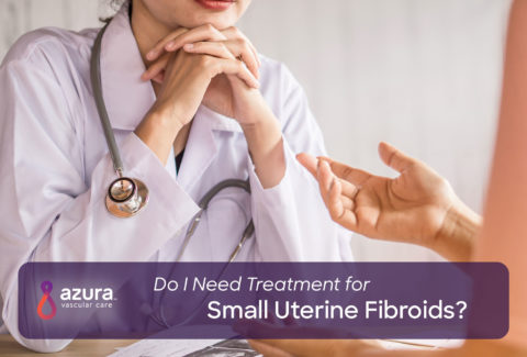 Do I Need Treatment for Small Uterine Fibroids? main image