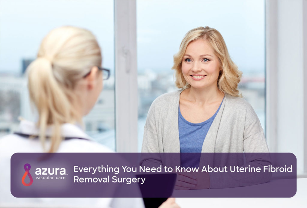 Everything You Need To Know About Uterine Fibroid Removal Surgery