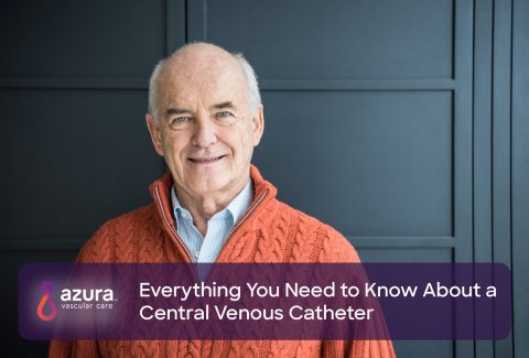 Vital Informations about Central Venous Catheter
