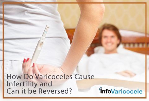 How Do Varicoceles Cause Infertility and Can It Be Reversed Image