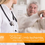 How to Avoid Critical Limb Ischemia, the Most Severe Form of PAD main image