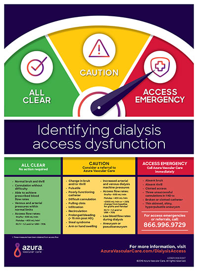 Identifying Dialysis Access Dysfunction