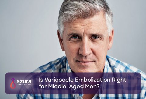 Is Varicocele Embolization Right for Middle-Aged Men?