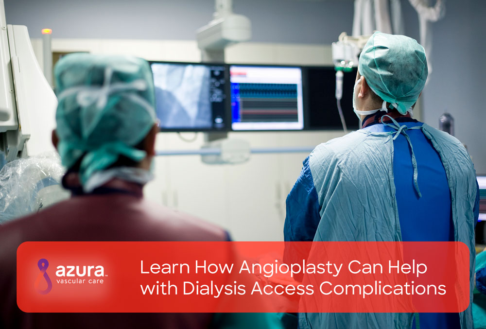 Learn How Angioplasty Can Help with Dialysis Access Complications main image
