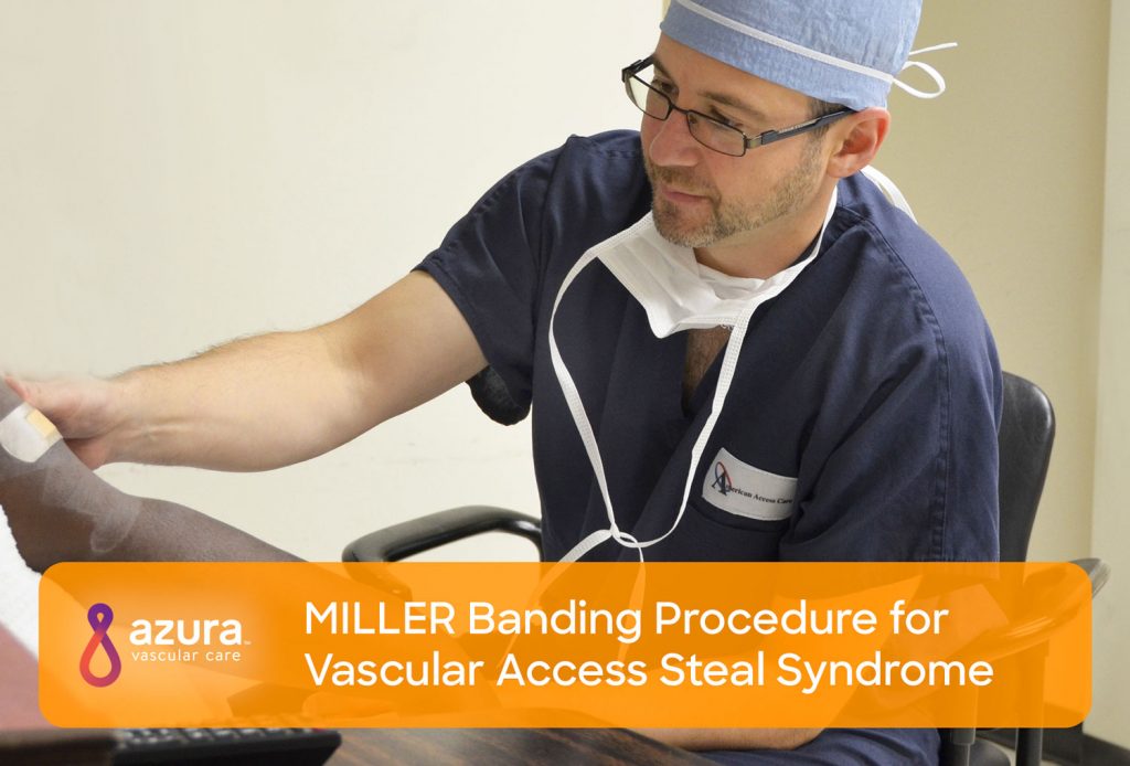 MILLER Banding Procedure for Vascular Access Steal Syndrome