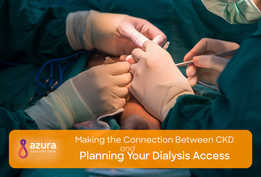 Making the Connection Between CKD and Planning Your Dialysis Access main image