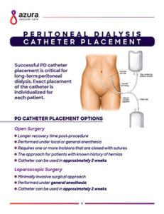 Peritoneal dialysis catheter placement fact sheet