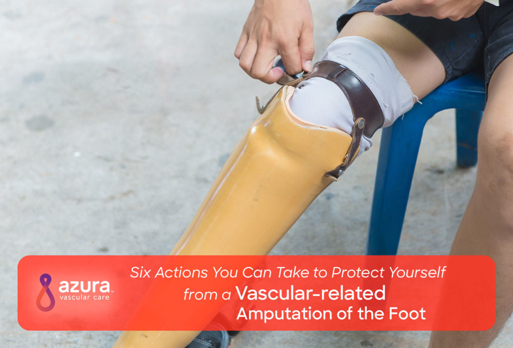six actions you can take to protect yourself from a vascular related amputation of the foot