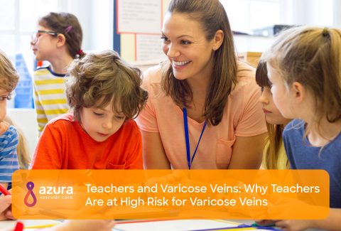 Why Teachers Are at High Risk for Varicose Veins
