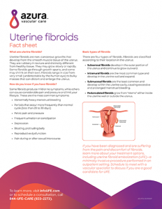 Uterine Fibroids Embolization fact sheet