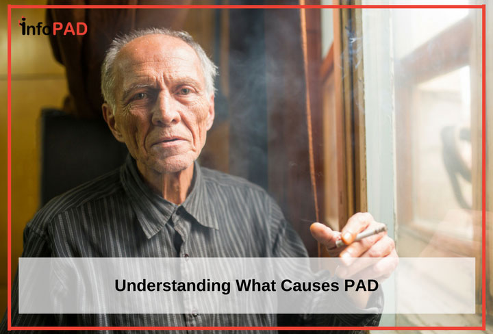 What Actually Causes PAD? 4 Of The Most Common Risk Factors For PAD
