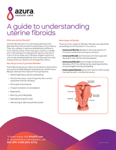 A guide to understanding uterine fibroids
