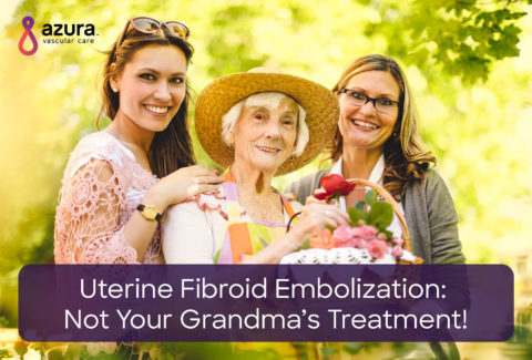 Uterine Fibroid Embolization – Not Your Grandma’s Treatment
