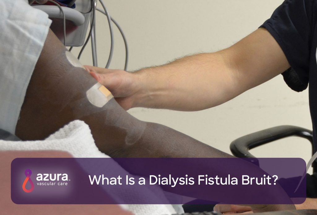 What Is a Dialysis Fistula Bruit?