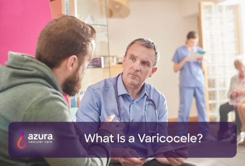 How Do I Know If I Have A Varicocele?