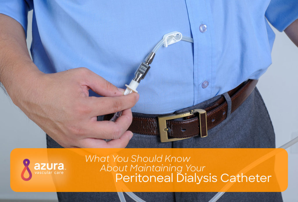What You Should Know About Maintaining Your Peritoneal Dialysis Catheter main image