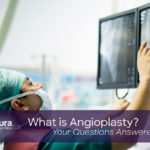 What is Angioplasty Your Questions Answered