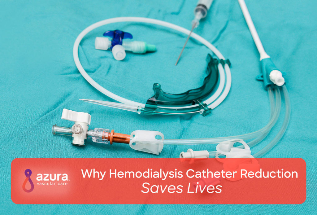 Why Hemodialysis Catheter Reduction Saves Lives