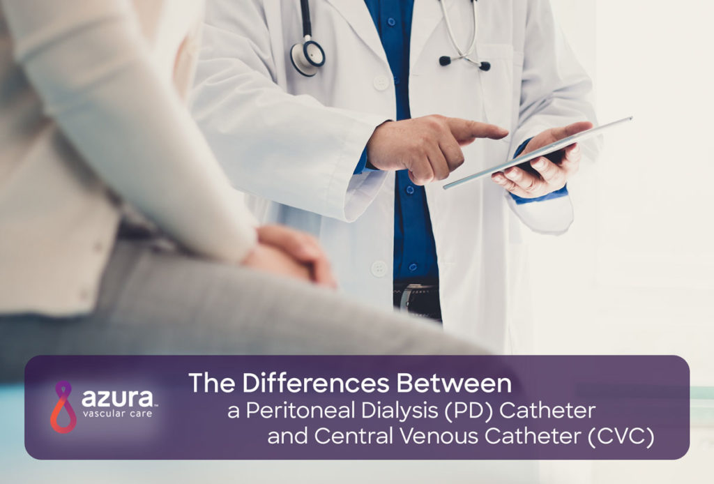 Differences between a PD and a CVC catheter