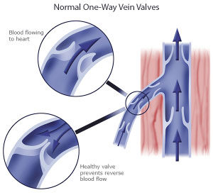 Varicose veins, normal one way vein valves