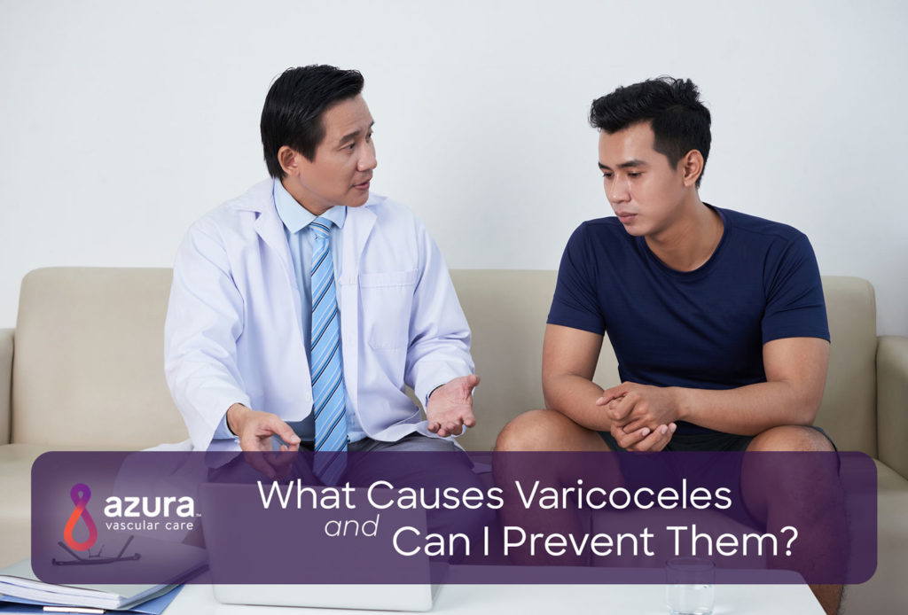 what causes varicoceles and can i prevent them main image