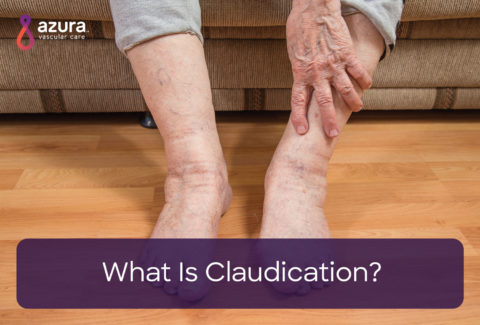 What is claudication main image