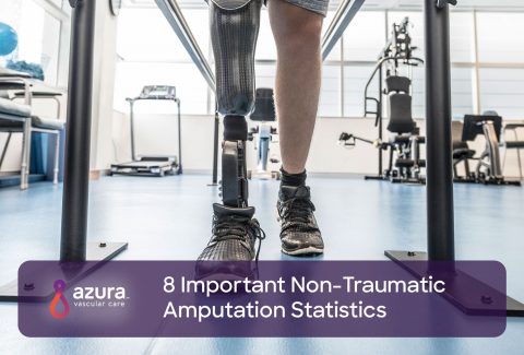 Important Non-Traumatic Amputation Statistics