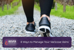 person walking, ways to manage varicose veins