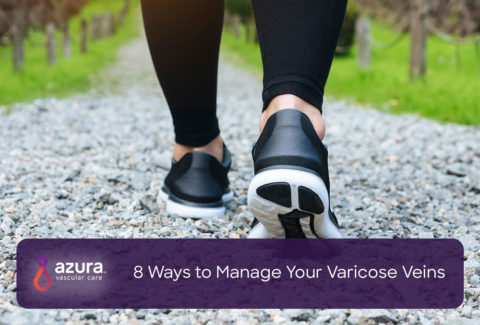 person walking, ways to manage varicose veins