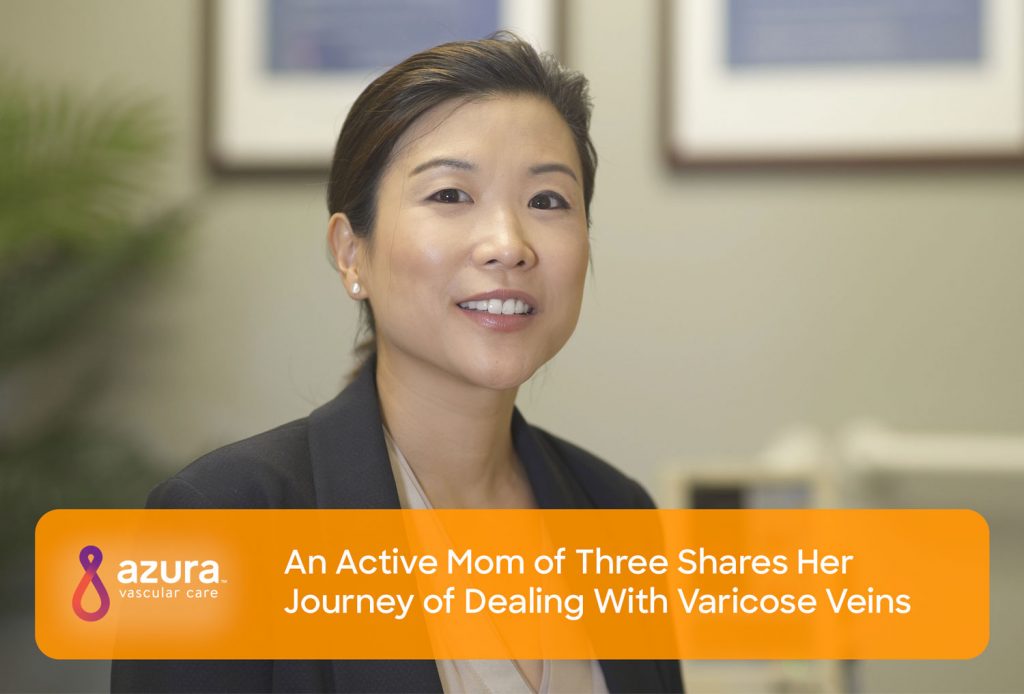 Active mom gets varicose veins treatment with Dr. Elsie Koh Woodland Park