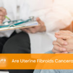 Are Uterine Fibroids Cancerous? main image