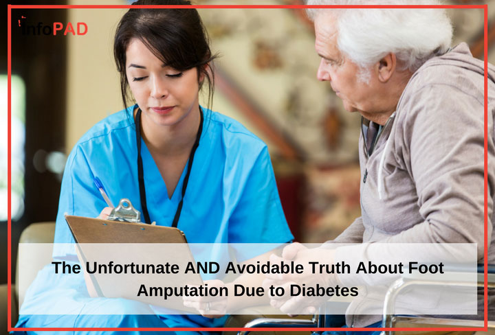 The Unfortunate AND Avoidable Truth About Foot Amputation Due To Diabetes