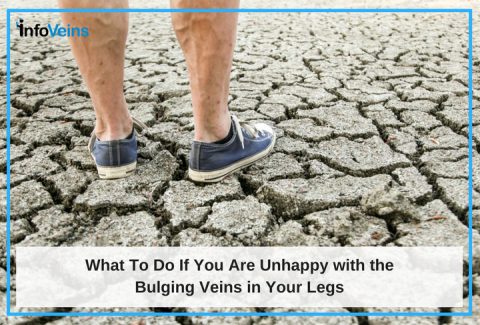 What To Do If You Are Unhappy With The Bulging Veins In Your Legs