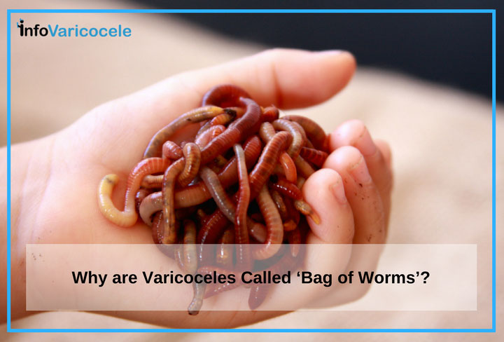Why are Varicoceles Called 'Bag of Worms'?