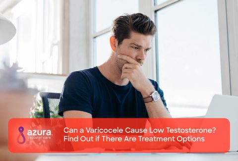 Can a Varicocele Cause Low Testosterone? Find Out if There Are Treatment Options