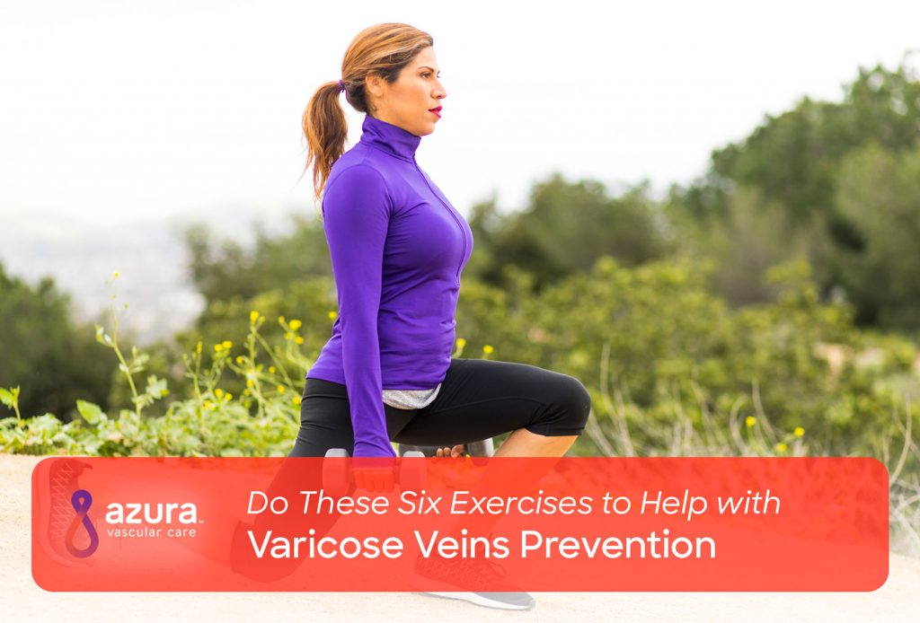 Do These Six Exercises to Help with Varicose Veins Prevention