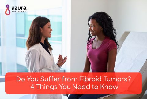 Do you suffer from fibroid tumors main image