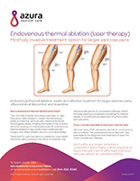 About Endovenous Thermal Ablation, Laser Therapy