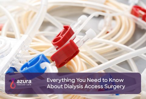 Everything You Need to Know About Dialysis Access Surgery
