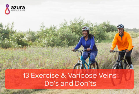 13 Exercise and Varicose Veins Do’s and Don’ts