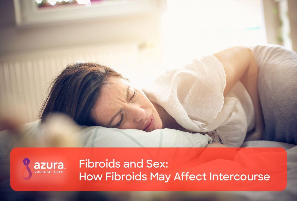 Fibroids and Sex: How Fibroids May Affect Intercourse