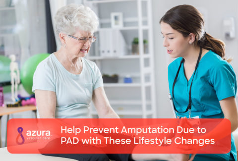 Help Prevent Amputation Due to PAD with These Lifestyle Changes