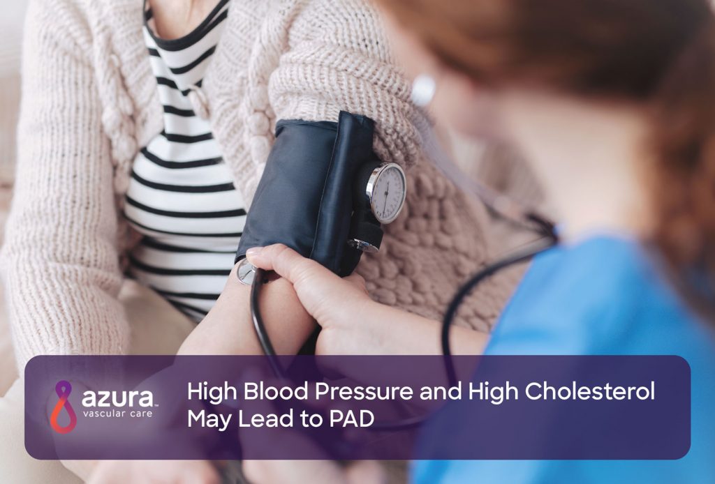 High Blood Pressure and High Cholesterol May Lead to PAD main image