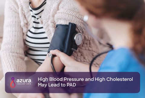 High Blood Pressure and High Cholesterol May Lead to PAD main image