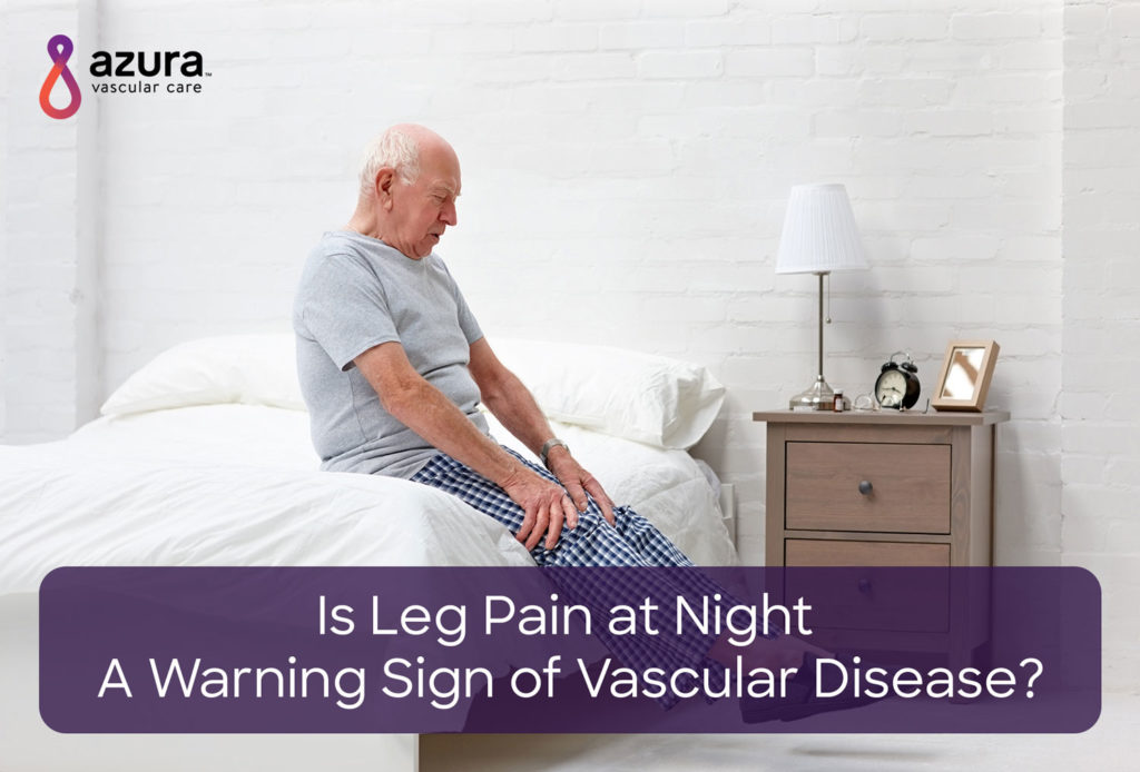 Is Leg  sadness at Night A  rebuke Sign of Vascular Disease?